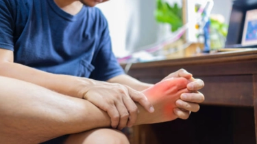 7 high uric acid symptoms that appear in hands and legs