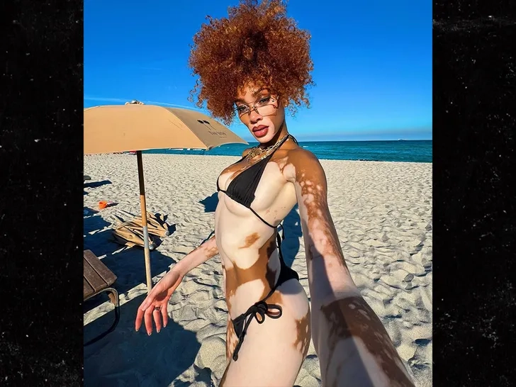 0717-Winnie-Harlow-Hot-Shot-SUB-2