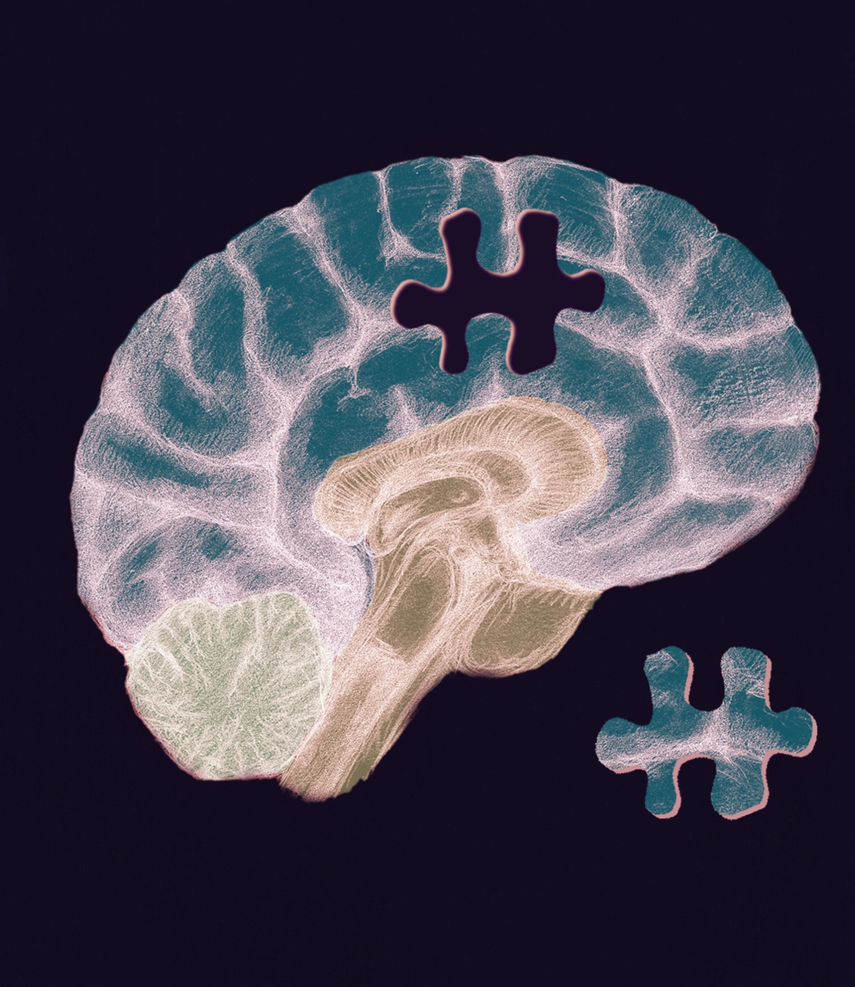 A colorized brain MRI scan with a puzzle piece missing