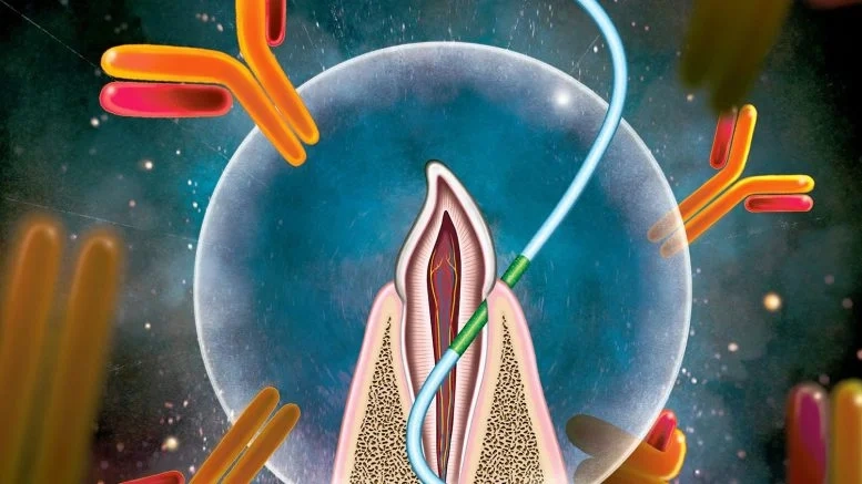Using Dental Floss to Introduce Vaccine