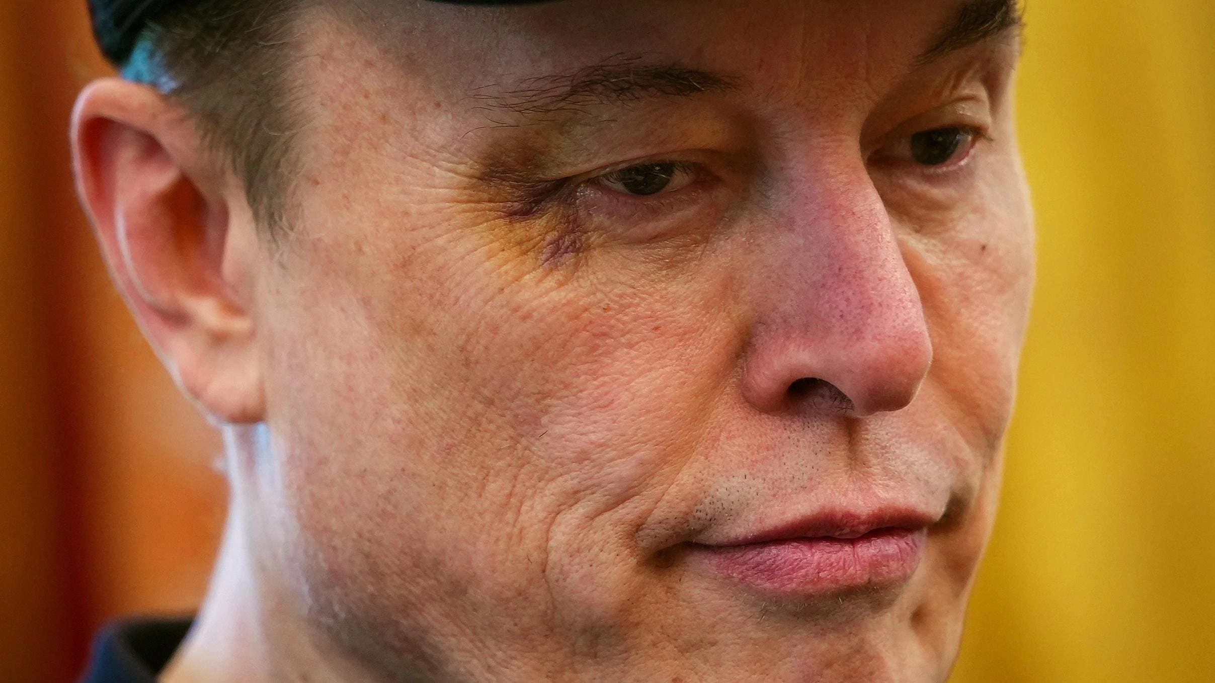 Elon Musk's Black Eye Fallout: Tesla's Reputation at Risk