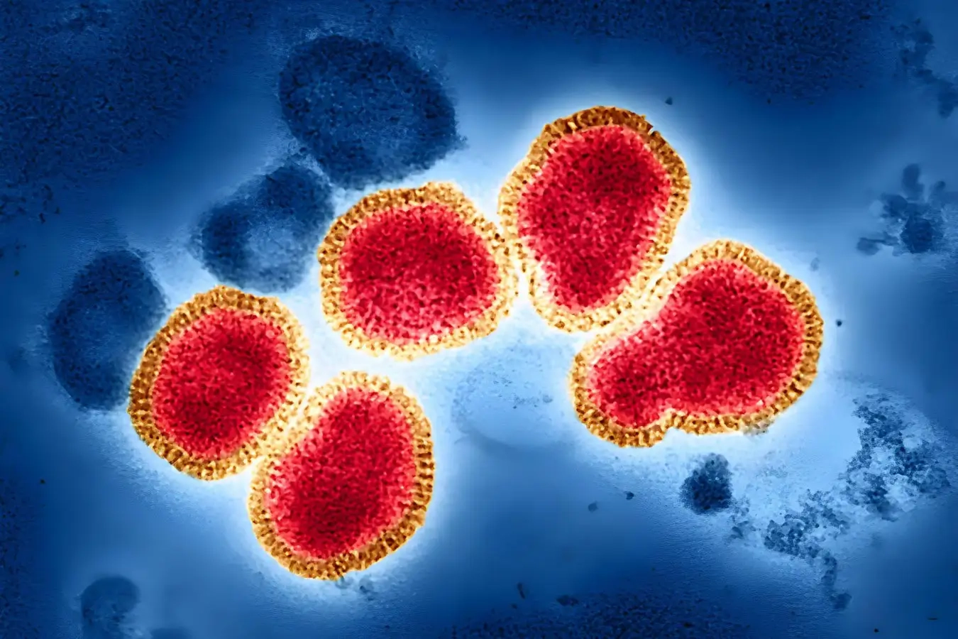 Long-Lasting Antiviral Drug Shows Promise in Protecting Against All Flu Strains