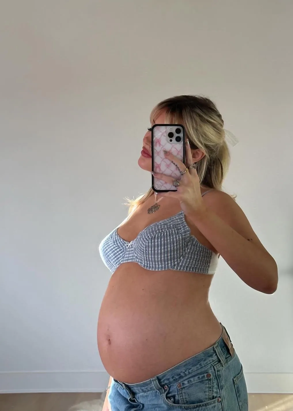 Influencer's Plastic Surgery Nightmare: Breast Implant Mishap Revealed