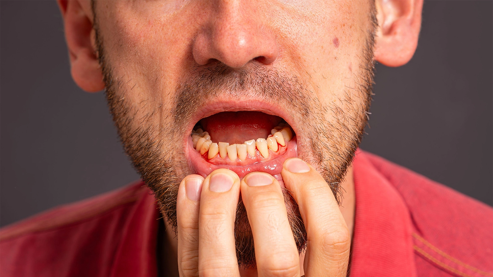 Preventing Ozempic Mouth: Expert Advice on Oral Health for GLP-1 Drug Users