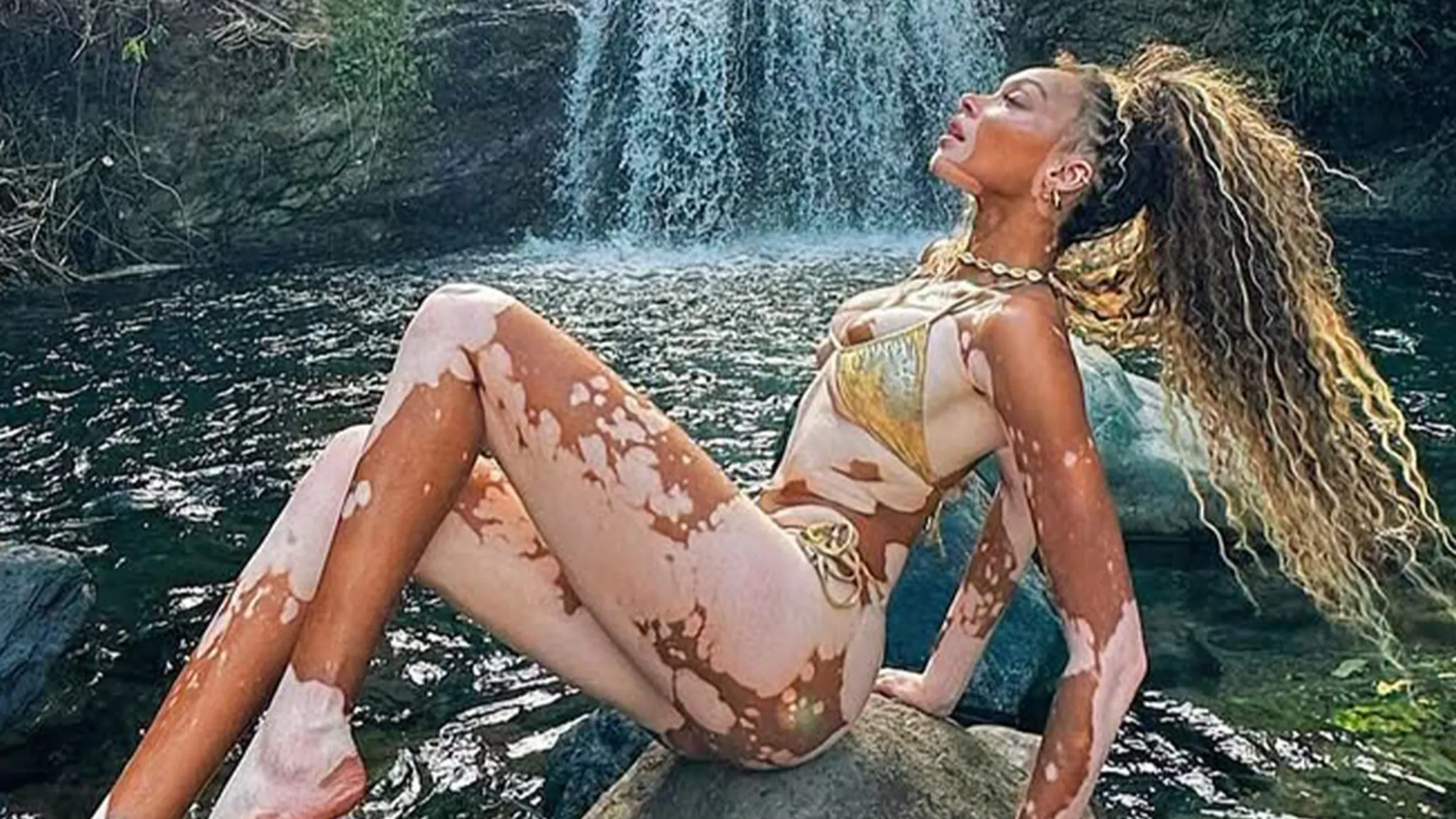 Winnie Harlow's 31st Birthday Bash: Hottest Bikini Shots Revealed!