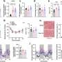Dietary Fat Source Impacts Tumor Growth in Obese Mice